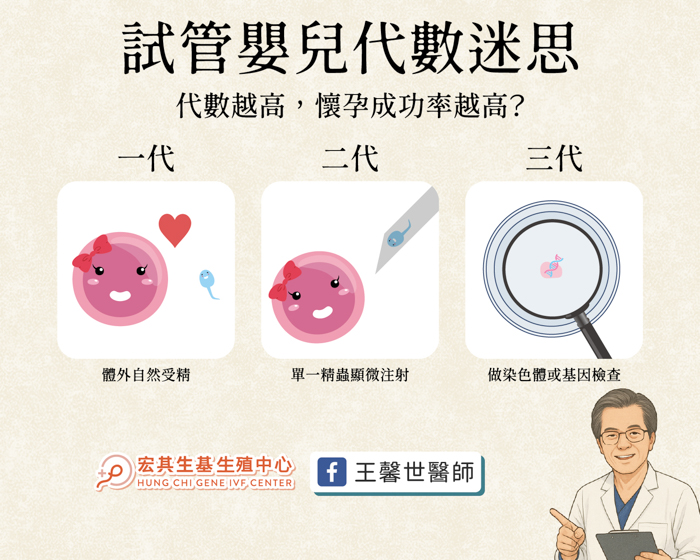 巧克力囊腫_工作區域 1-2