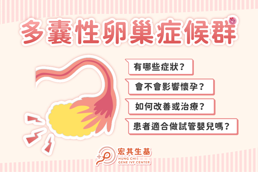 多囊網站_工作區域 1 多囊網站_工作區域 1