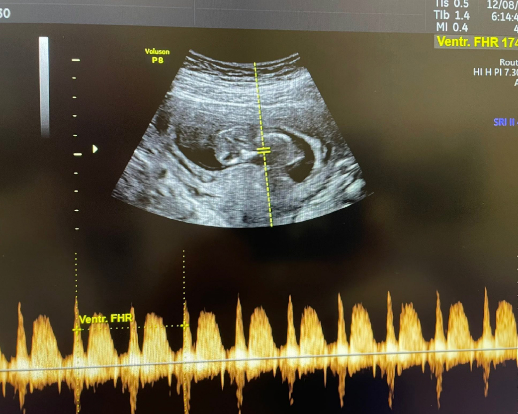 醫師分享_1141215-04