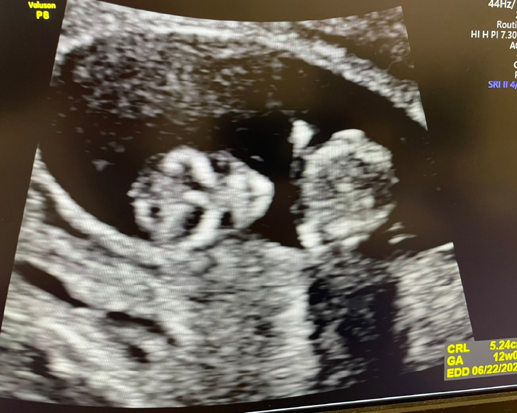 醫師分享_1141215-03