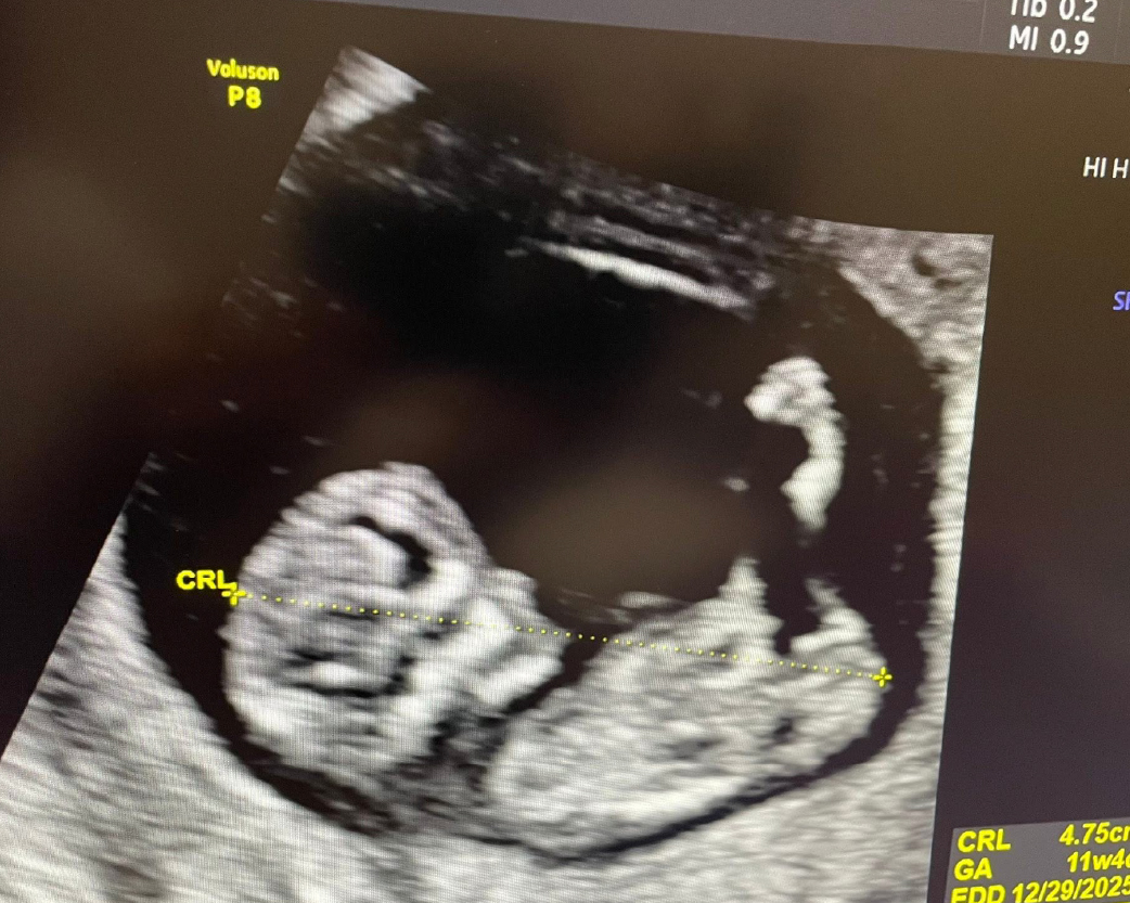 醫師分享_1150210-05