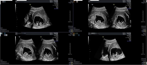 669765753_1567267862073456_4257711902304908787_n