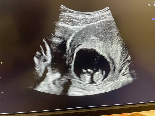 669848180_1567272518739657_3180940582540128801_n