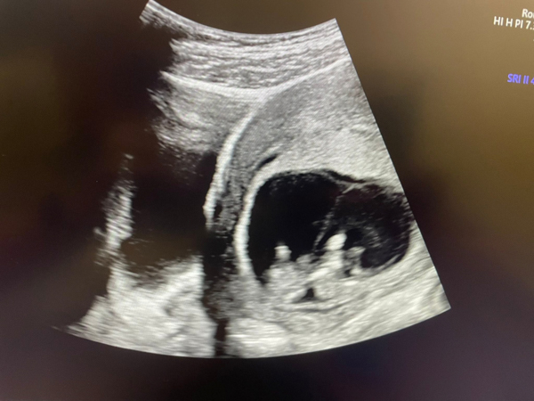 669346963_1567272508739658_8164647010914301076_n