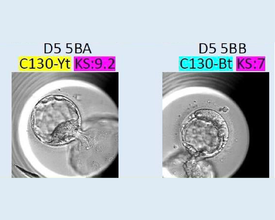 醫師分享_黃副_1150414-03
