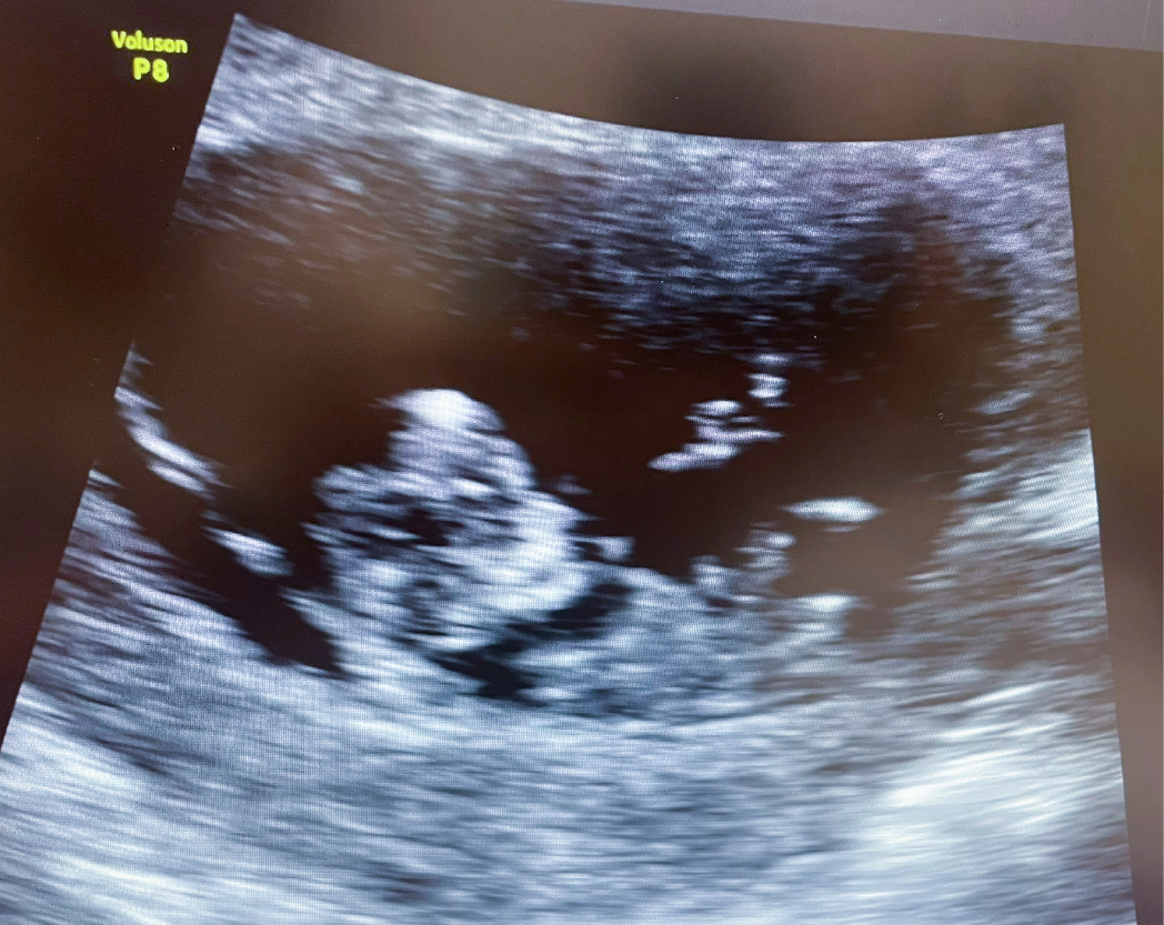 醫師分享_黃副_1150414-02