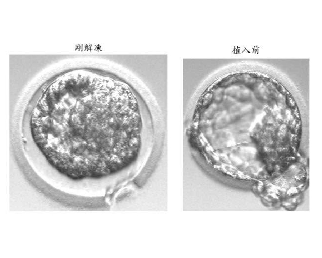 醫師分享_黃副_1150625-03