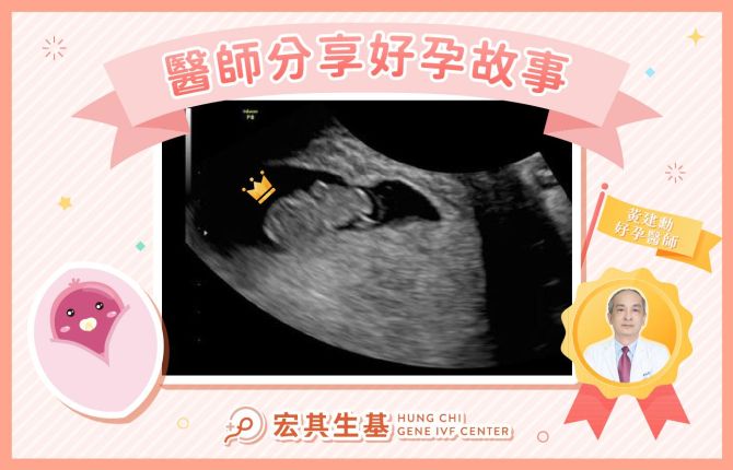 醫師分享好孕故事