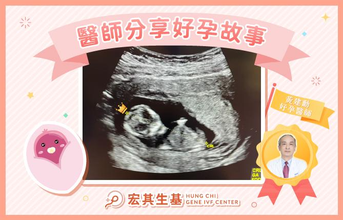 醫師分享好孕故事