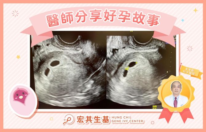 醫師分享好孕故事