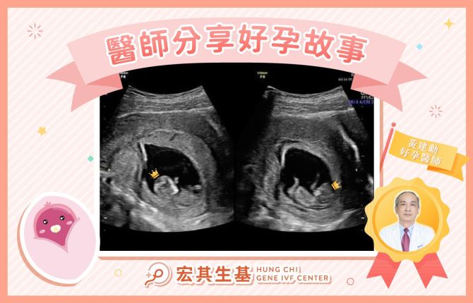 醫師好孕分享