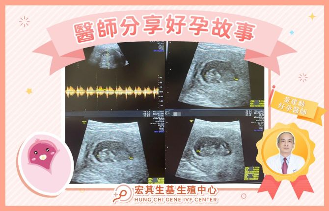 醫師好孕分享