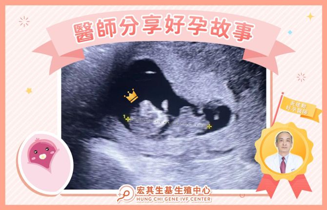 醫師好孕分享