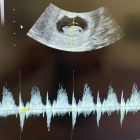 醫師分享_黃副1203-03