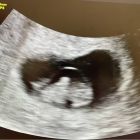 醫師分享_黃副1203-05