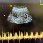 醫師分享_1141215-04