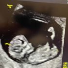 醫師分享_1150210-05