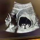 669848180_1567272518739657_3180940582540128801_n