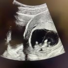 669346963_1567272508739658_8164647010914301076_n