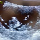 醫師分享_黃副_1150414-02