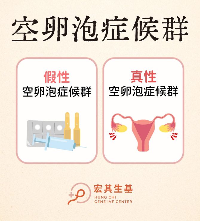 什麼是空卵泡症候群？