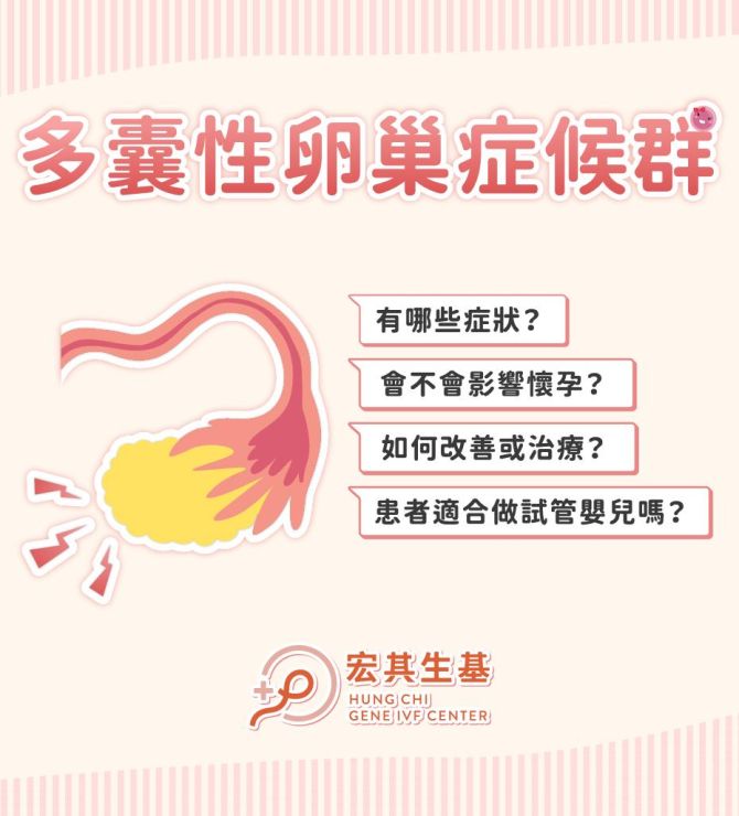 多囊性卵巢症候群
